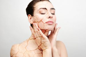 Como cuidar da pele seca? Conheça os tipos de pele ressecada